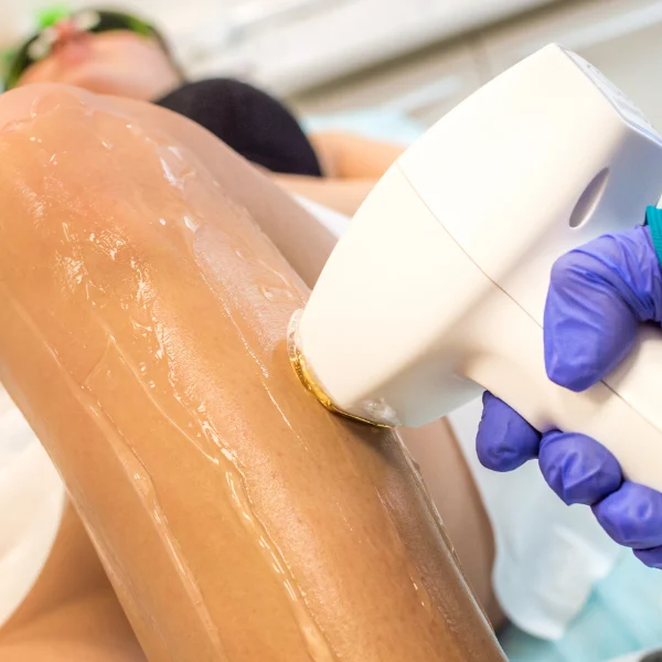 a qué edad se puede hacer la depilación láser